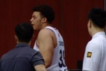难顶啊😳&ldquo;小胖&rdquo;洛夫顿眉角被呼了一巴掌打裂了 满是鲜血